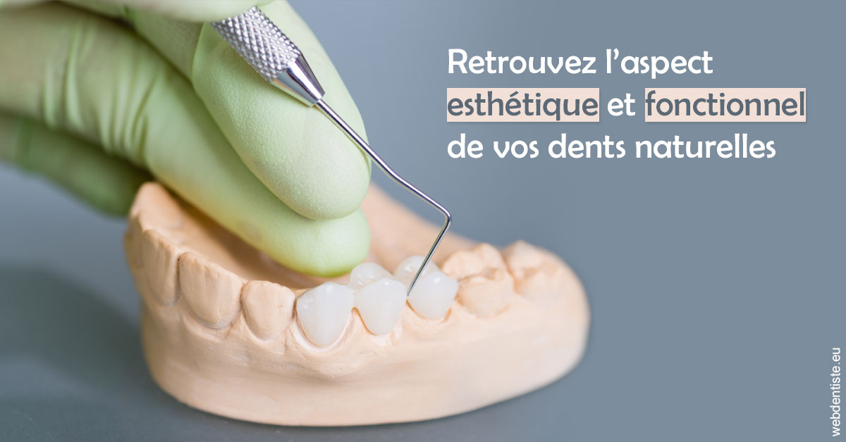 https://dr-samuel-lefevre.chirurgiens-dentistes.fr/Restaurations dentaires 1