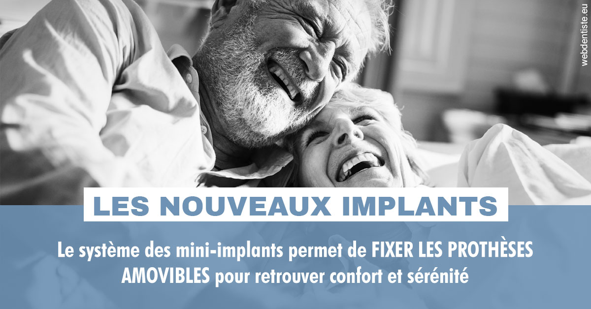 https://dr-samuel-lefevre.chirurgiens-dentistes.fr/Les nouveaux implants 2