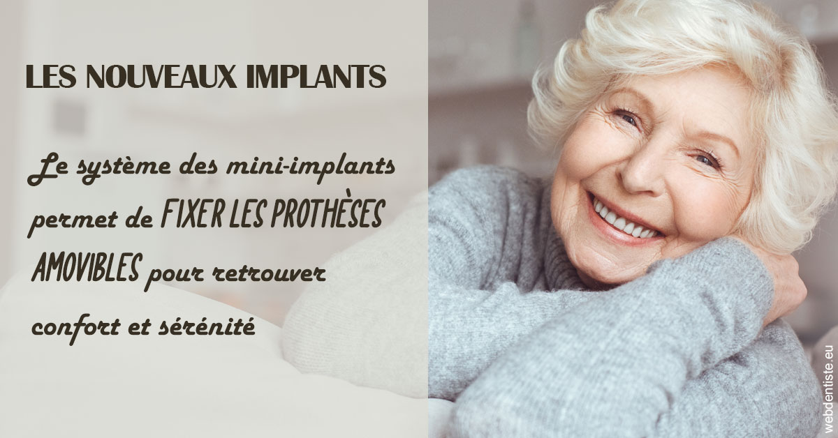 https://dr-samuel-lefevre.chirurgiens-dentistes.fr/Les nouveaux implants 1
