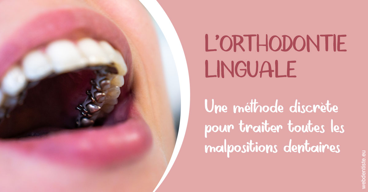 https://dr-samuel-lefevre.chirurgiens-dentistes.fr/L'orthodontie linguale 2