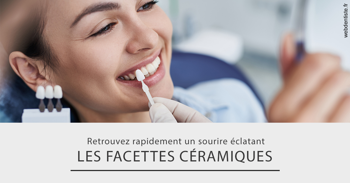 https://dr-samuel-lefevre.chirurgiens-dentistes.fr/Les facettes céramiques 2