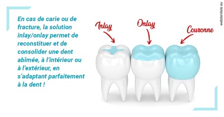 https://dr-samuel-lefevre.chirurgiens-dentistes.fr/L'INLAY ou l'ONLAY