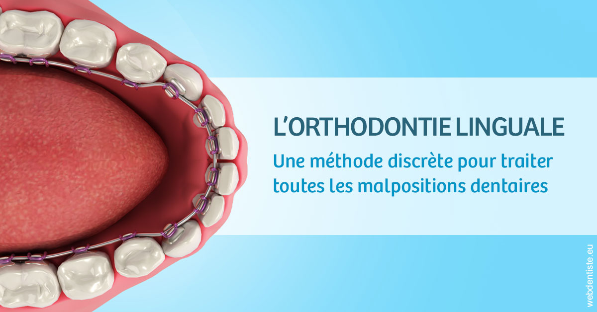 https://dr-samuel-lefevre.chirurgiens-dentistes.fr/L'orthodontie linguale 1