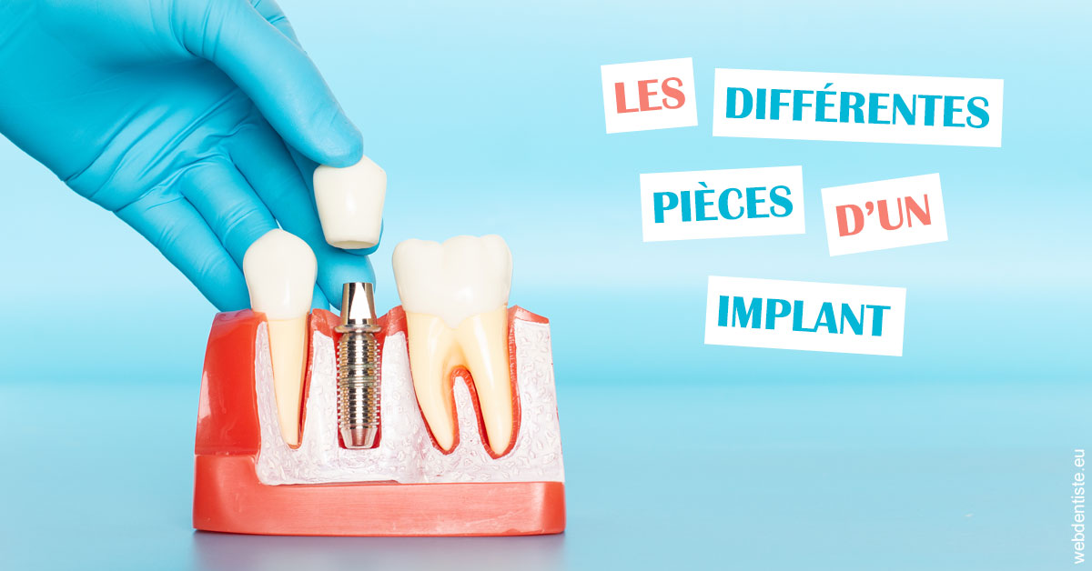 https://dr-samuel-lefevre.chirurgiens-dentistes.fr/Les différentes pièces d’un implant 2