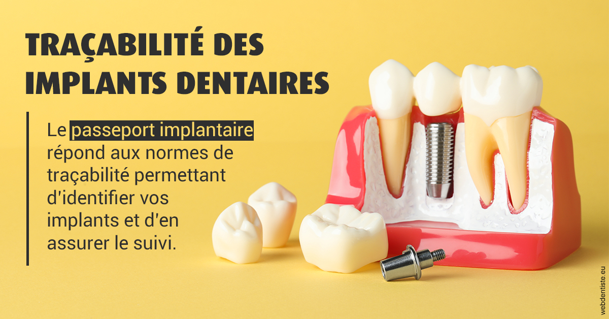 https://dr-samuel-lefevre.chirurgiens-dentistes.fr/T2 2023 - Traçabilité des implants 2