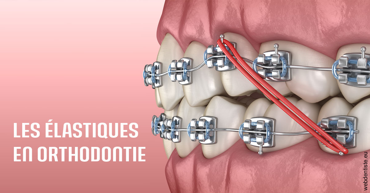 https://dr-samuel-lefevre.chirurgiens-dentistes.fr/Elastiques orthodontie 2