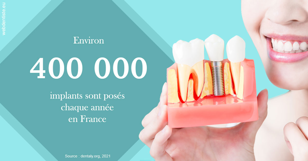 https://dr-samuel-lefevre.chirurgiens-dentistes.fr/Pose d'implants en France 2